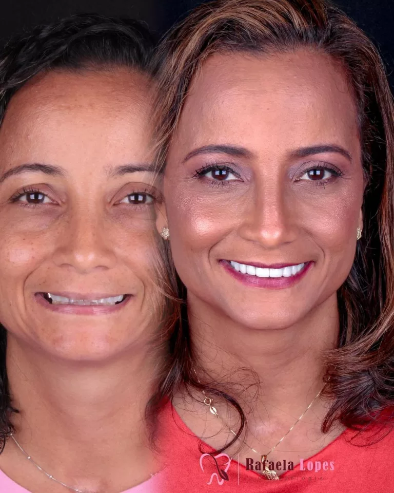 cinara_antes_depois_perfil