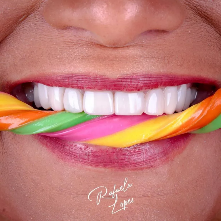 cinara_depois_sorriso