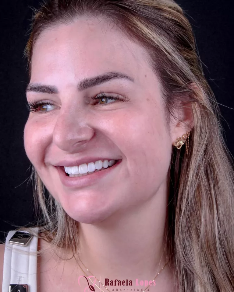 loira sorriso1