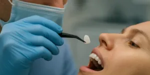 Preço das lentes de contato dental