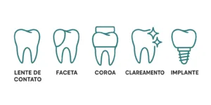 comparação entre lente de contato dental, coroa, implante e clareamento