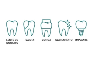 comparação entre lente de contato dental, coroa, implante e clareamento