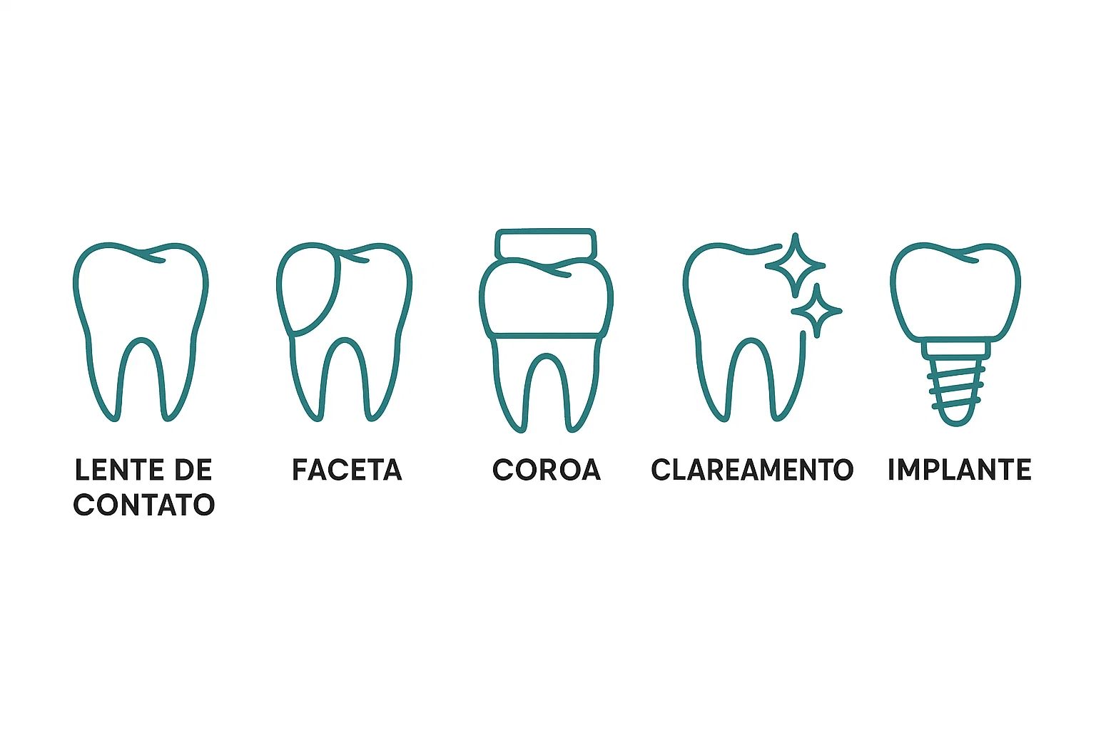 comparação entre lente de contato dental, coroa, implante e clareamento