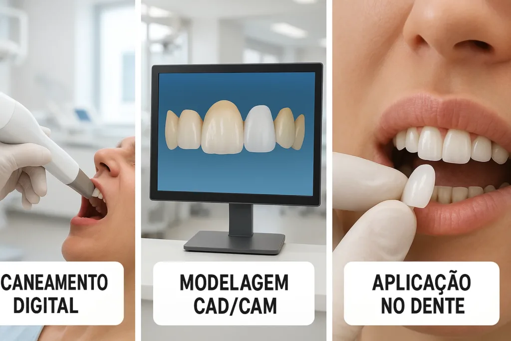 sequência ilustrativa mostrando as etapas do tratamento com lentes de contato dental